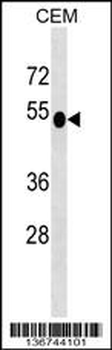 DUSP6 Antibody (N-term)