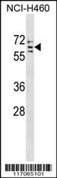 CYP4V2 Antibody (C-term)