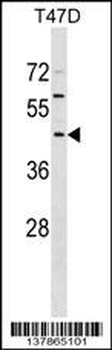 FBXO16 Antibody (C-term)