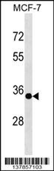 EPSTI1 Antibody (N-term)