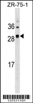 SPC25 Antibody (Center)