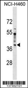 SDCCAG8 Antibody (N-term)