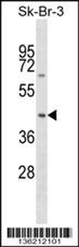 SNX7 Antibody (Center)