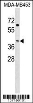 NECAB2 Antibody (N-term)