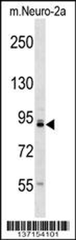 Mouse Tlk1 Antibody (C-term)