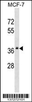 MRPL2 Antibody (C-term)