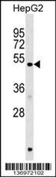 HERPUD1 Antibody (N-term)