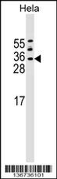 ASF1A Antibody (C-term)