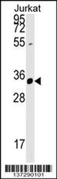 ZFYVE27 Antibody (N-term)