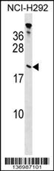 TPPP Antibody (Center)