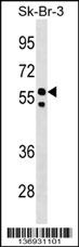 FBXO31 Antibody (Center)