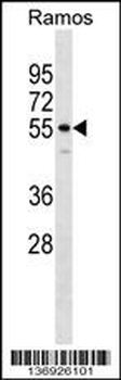 IQCB1 Antibody (Center)