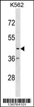 CX3CR1 Antibody (N-term)