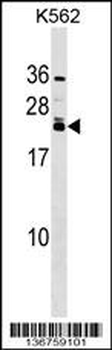 HAND2 Antibody (Center)