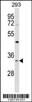 STX2 Antibody (N-term)