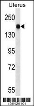 CGNL1 Antibody (N-term)