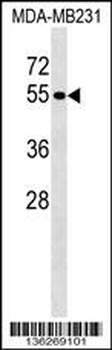 PTPN18 Antibody (C-term)