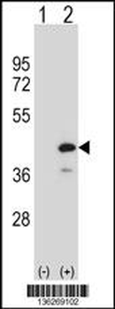 PTPN18 Antibody (C-term)