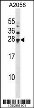 UBE2H Antibody (Center)