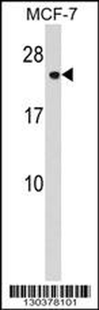 CHMP1A Antibody (N-term)