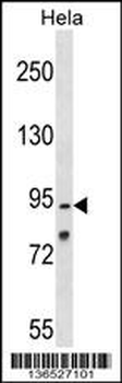 OSBPL1A Antibody (C-term)