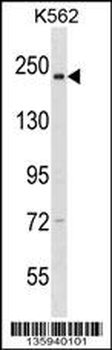 NCAPD3 Antibody (C-term)