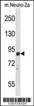 ZDHHC8 Antibody (C-term)