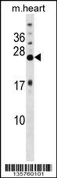 KCNIP4 Antibody (N-term)