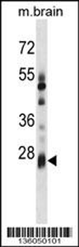 KCTD6 Antibody (Center)