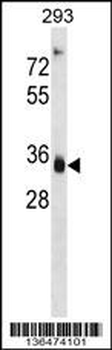 AKR1D1 Antibody (Center)