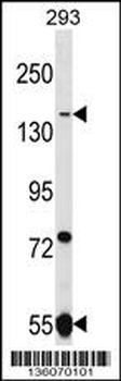UHRF1BP1L Antibody (Center)