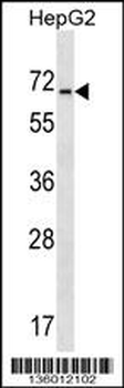 ACCN4 Antibody (N-term)