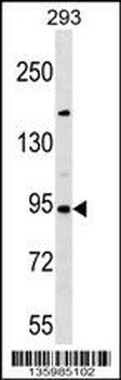SEMA3D Antibody (C-term)