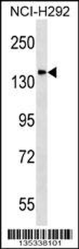 DLGAP4 Antibody (N-term)
