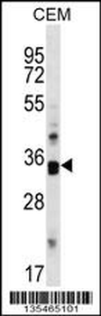 Mouse Cdk10 Antibody (C-term)