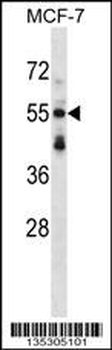 SNTB2 Antibody (Center)