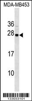 SYNGR1 Antibody (C-term)