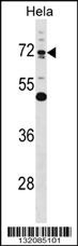 EPN1 Antibody (Center)