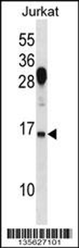 RHOG Antibody (C-term)