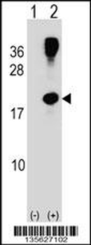 RHOG Antibody (C-term)