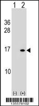 HIST1H2BB/HIST1H2BE Antibody (N-term)