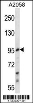 E2F7 Antibody (Center)