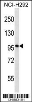 PTHD2 Antibody (N-term)
