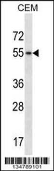 Mouse Hck Antibody (N-term)
