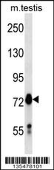 Mouse Mark4 Antibody (C-term)