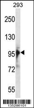 RBM10 Antibody (N-term)