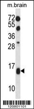 TCEB2 Antibody (N-term)