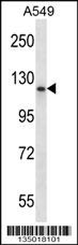PMS1 Antibody (C-term)
