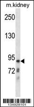 CLCNKB Antibody (N-term)