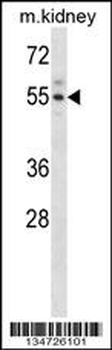 Mouse Acvr2a Antibody (N-term)